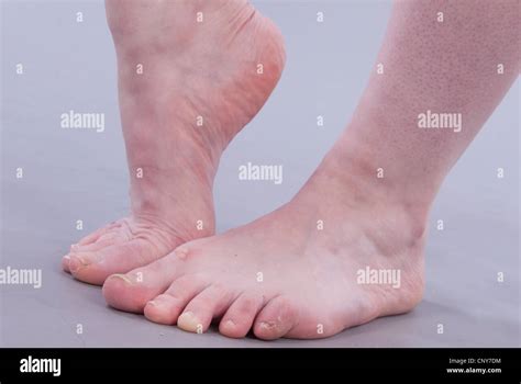 ugly feet pics|Ugly Feet Pictures, Images and Stock Photos